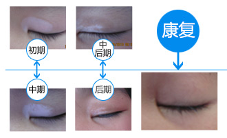 暑期白癜风专项普查计划